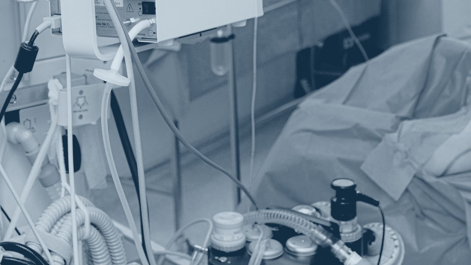 A patient monitor displaying vital signs in an intensive care setting